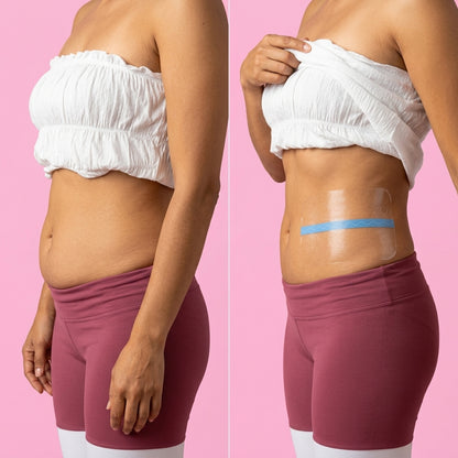 Abdomen de perfil antes y con la cinta Tersanova