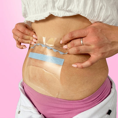Colocando la cinta Tersanova en el abdomen